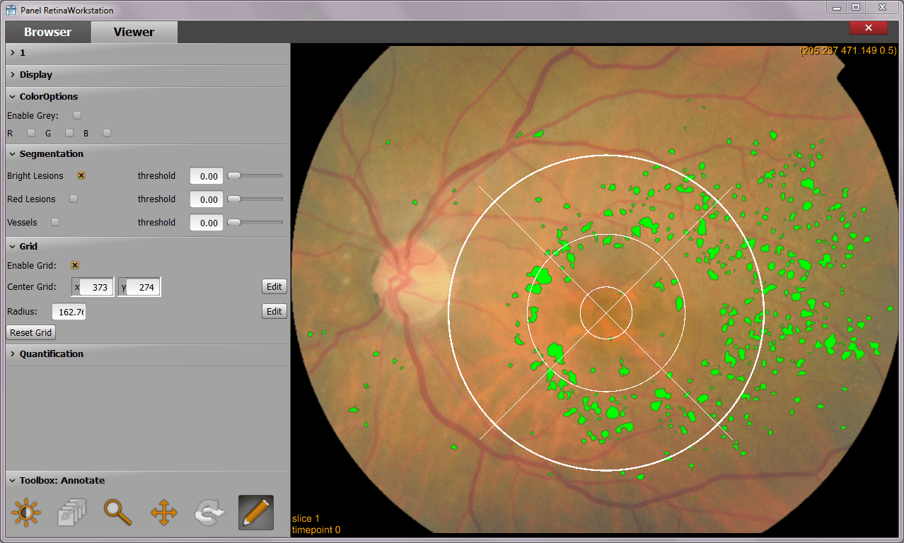 Modelo Retina Modelo Retina